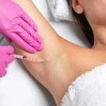 Excessive Sweating Treatment