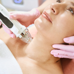 Neck Rejuvenation