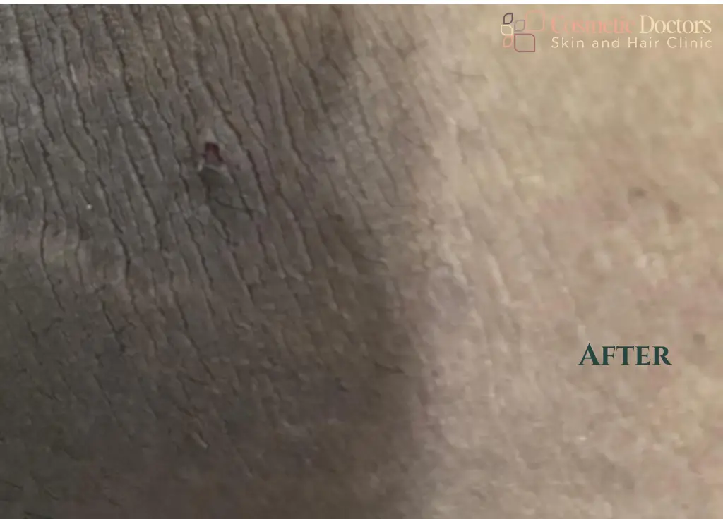 Laser & Body Contouring