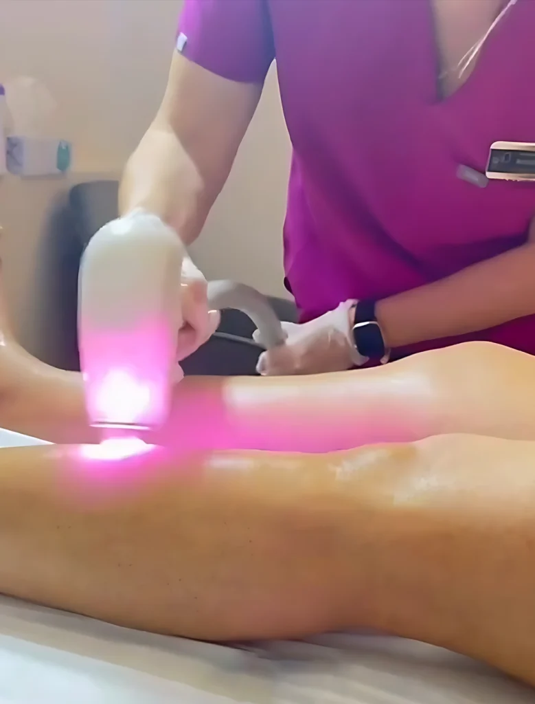Laser Hair Removal