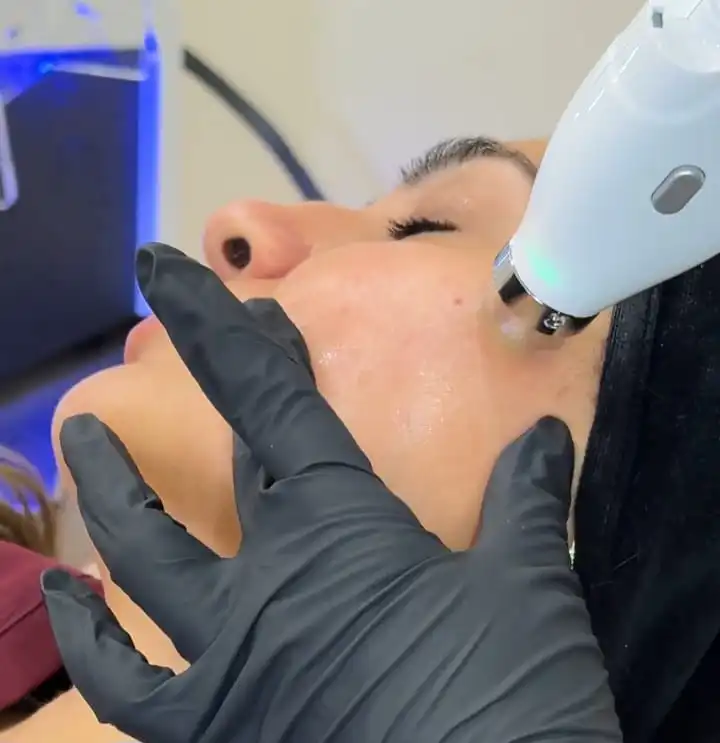 Needle-Free Mesotherapy