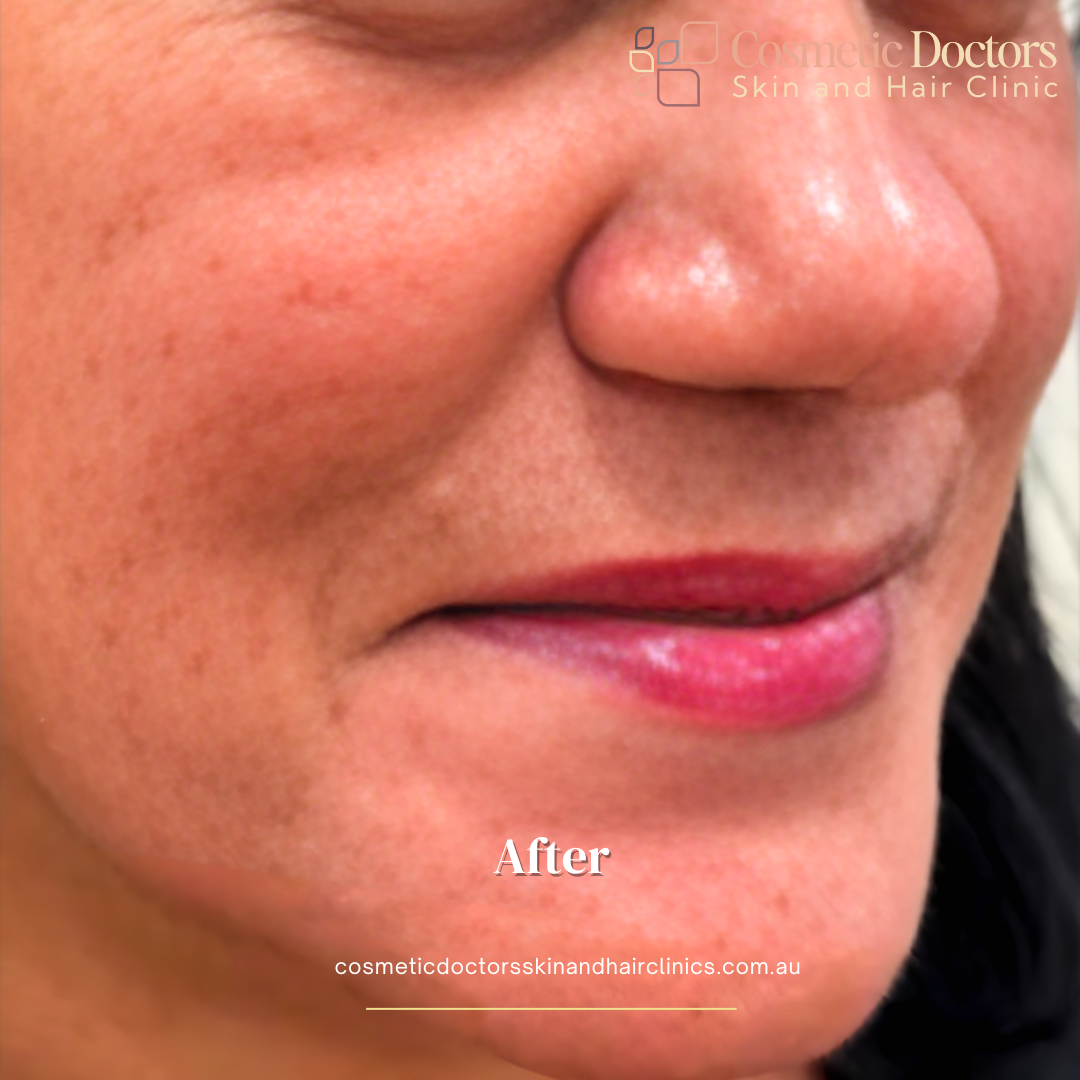 Advanced Skin Treatments