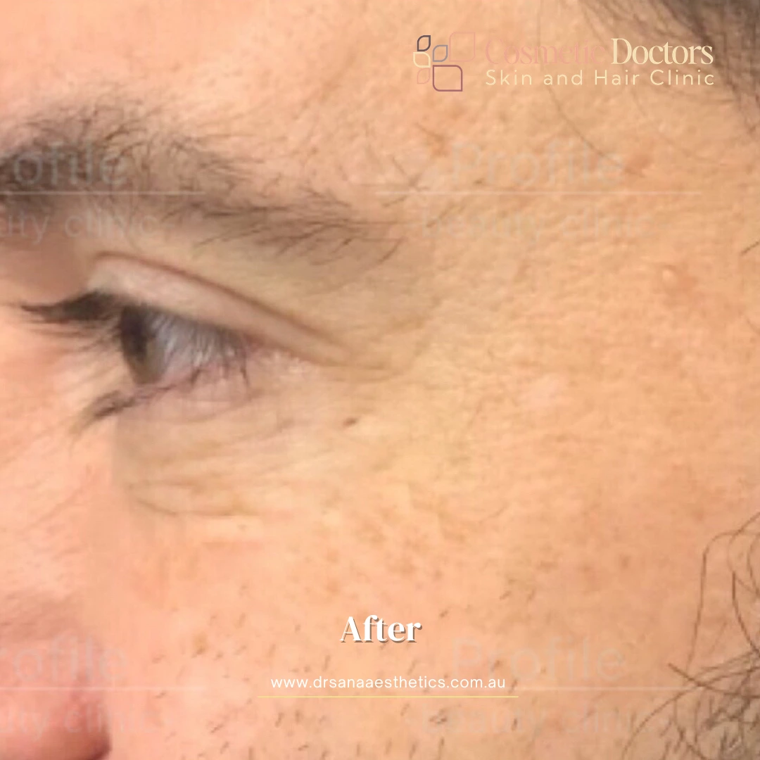 14.webp