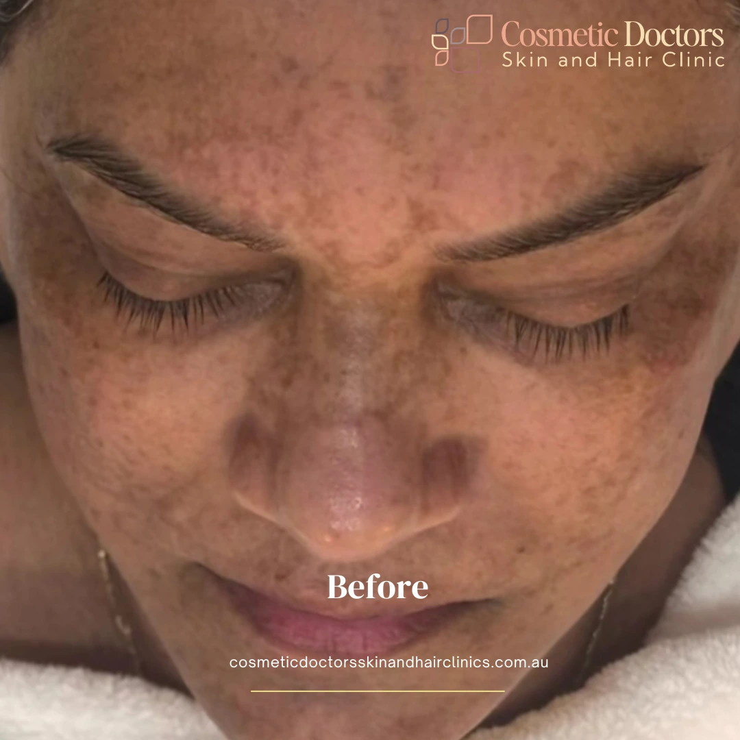 before-treatment-2