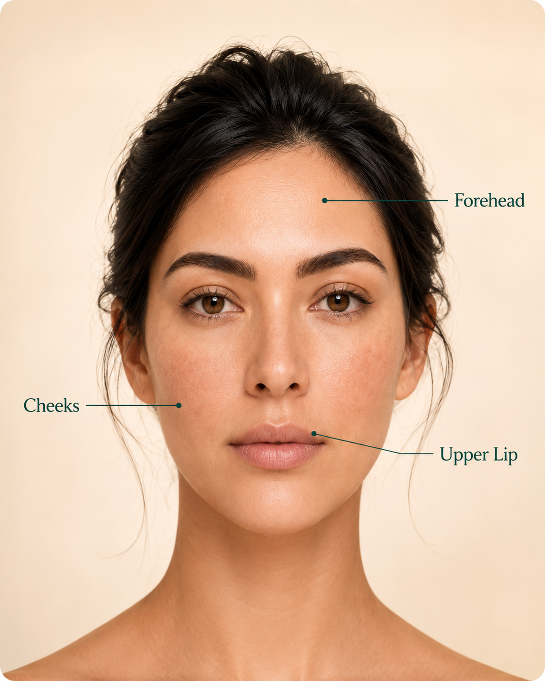 Front-facing portrait of a woman with callout lines highlighting the forehead, cheeks, and upper lip as common areas affected by reduced skin firmness.