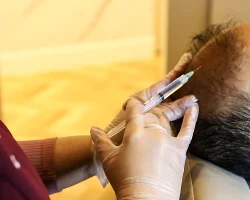 Hair Restoration